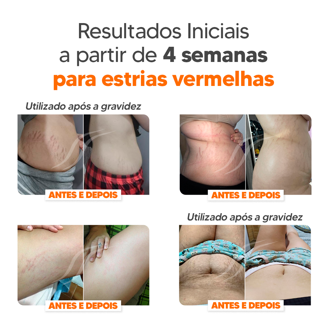 Kit Cicatrissim 2un + Hidratante 1un