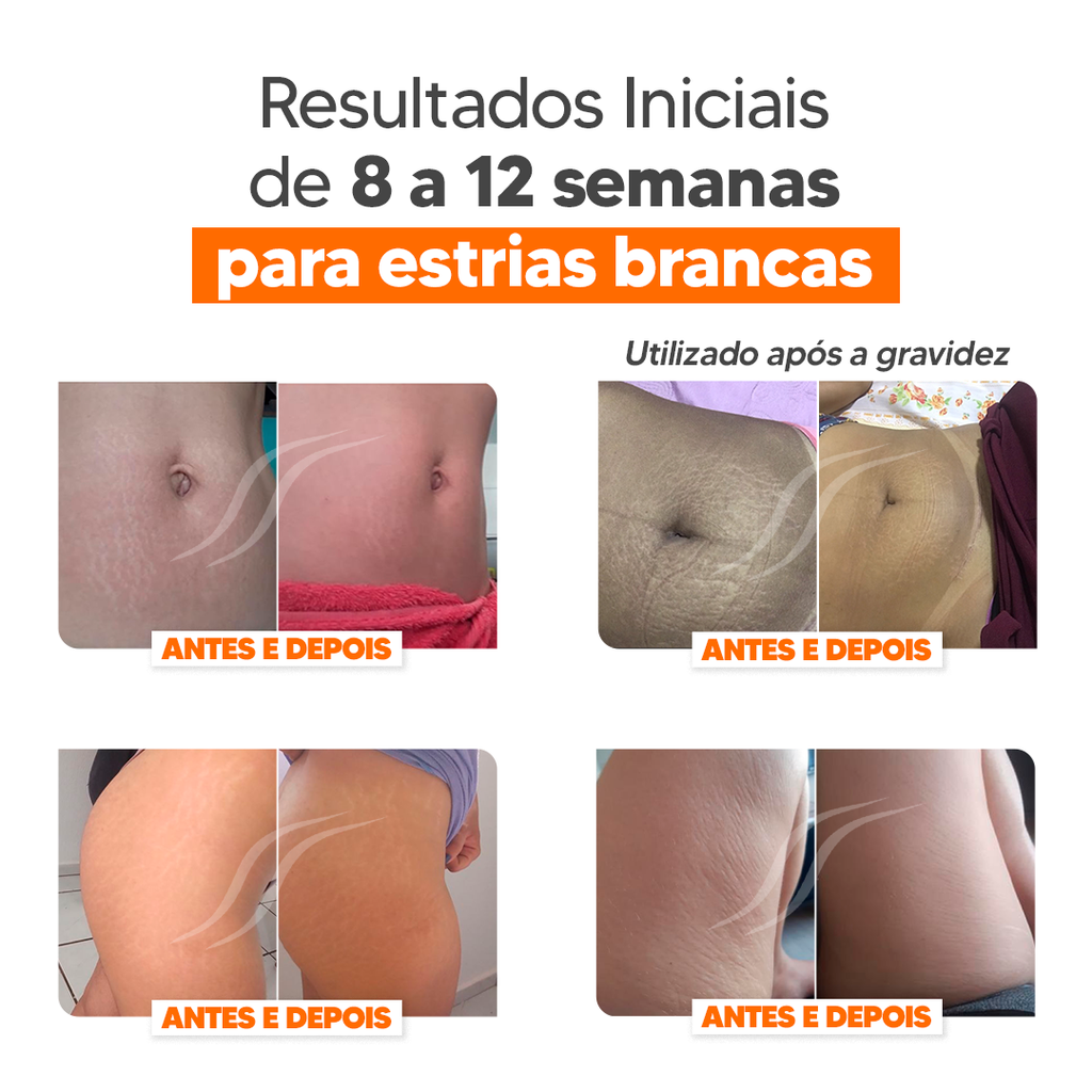 Kit Cicatrissim 2un + Hidratante 1un