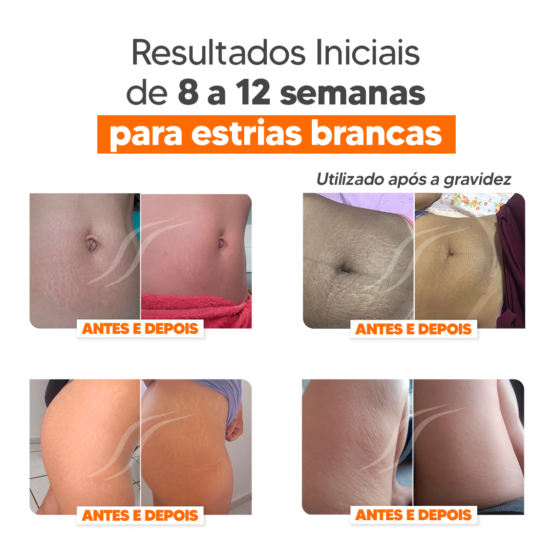 Kit Cicatrissim 2un + Hidratante 1un